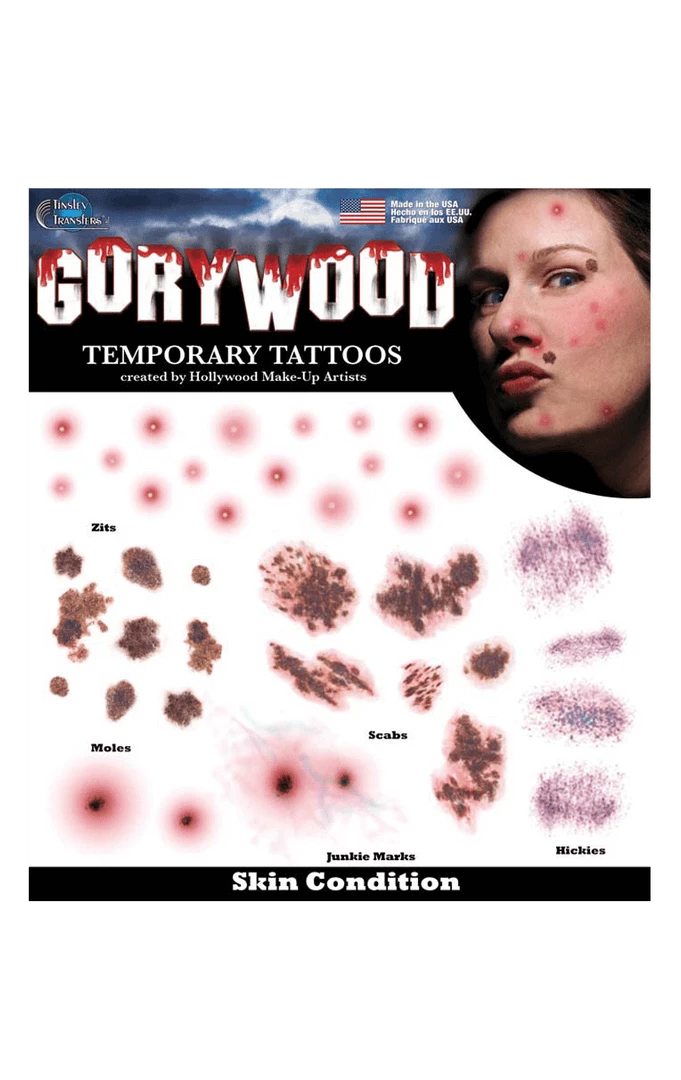 Tinsley Transfers All Themes Skin Condition Gorywood Transfers 3 Tinsley Transfers All Themes Skin Condition Gorywood Transfers